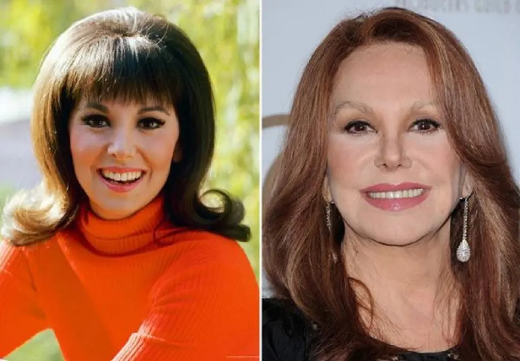 Marlo Thomas before and after photos 