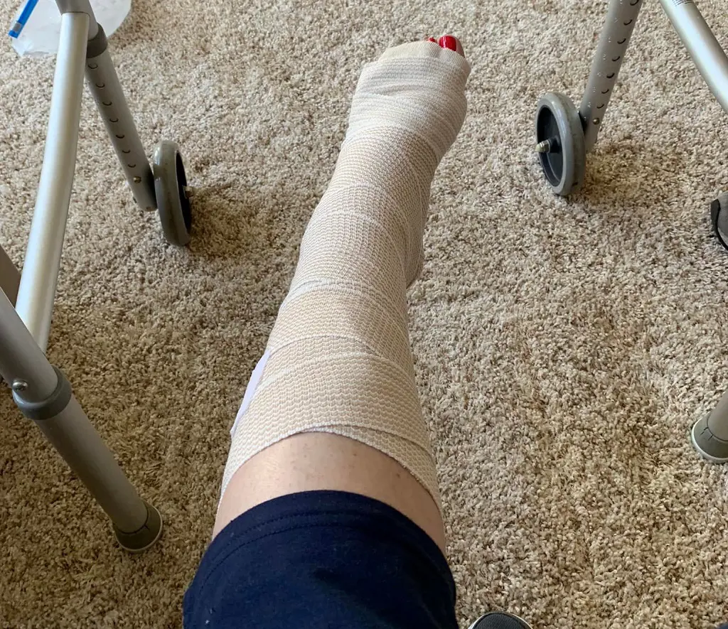 Mary Beth Roe's injured ankle